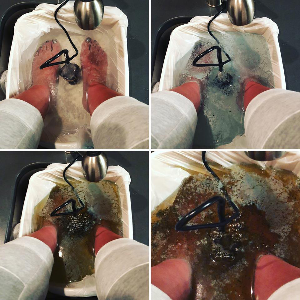 Foot Detox 1